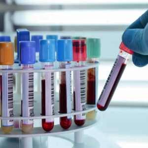 Paquete QS3-2 Glucosa-Colesterol-Triglicéridos