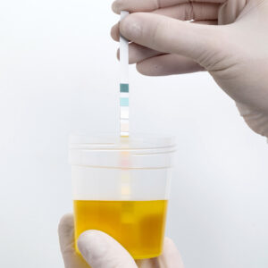 Paquete perfil antidoping 6 Parámetros