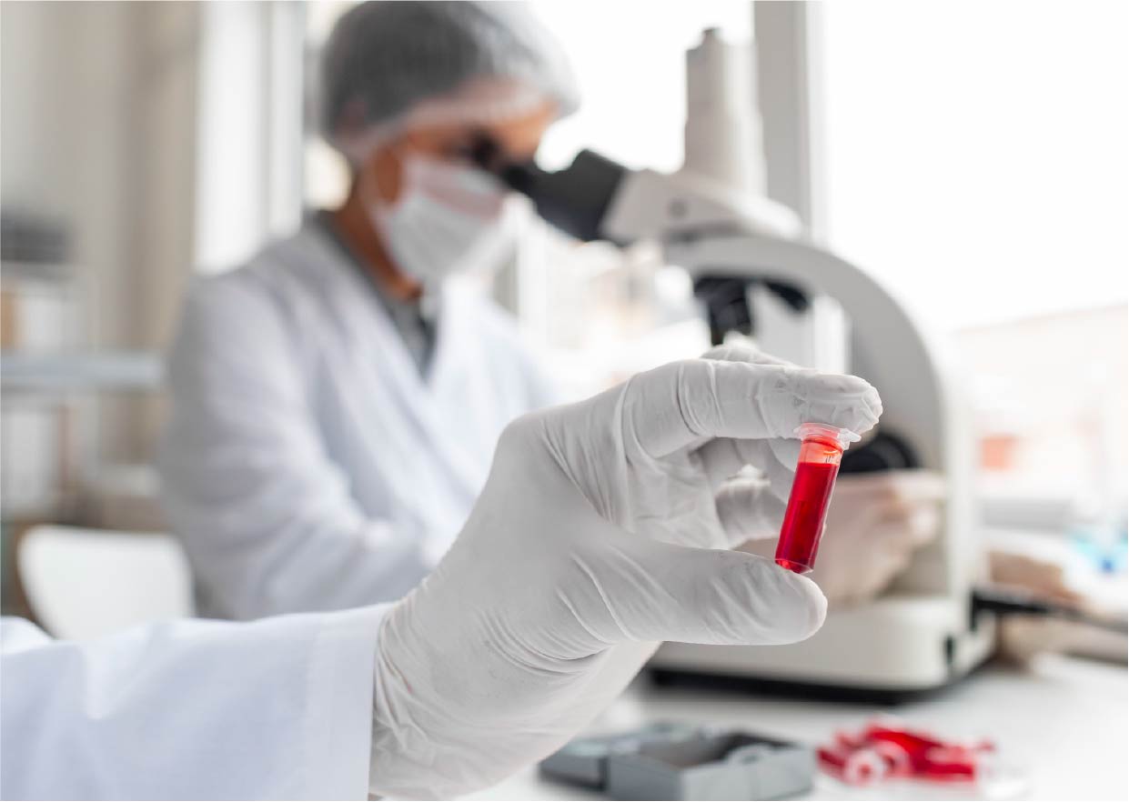 Cómo prepararte para un análisis de sangre